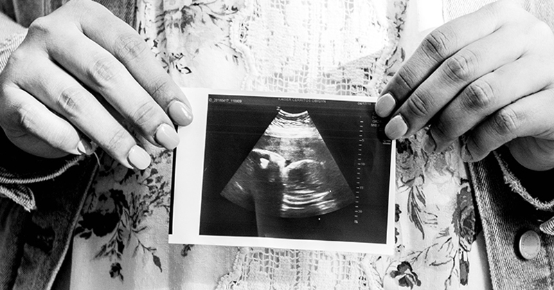 Ultrasound SCOTUS Ruling