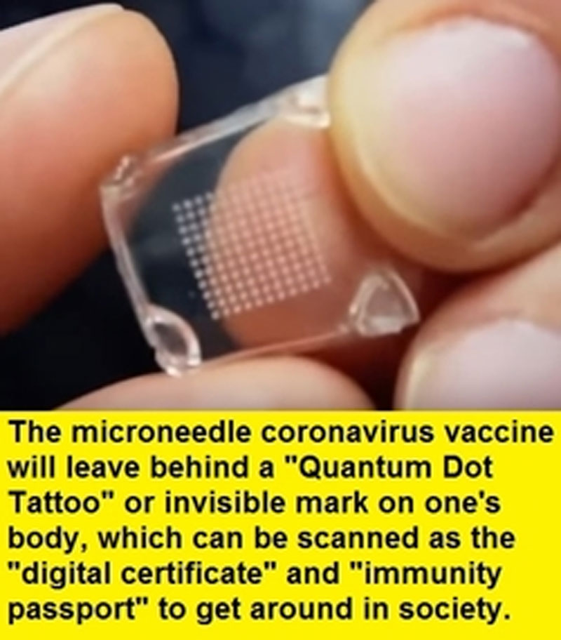 Microneedle Coronavirus Vaccine